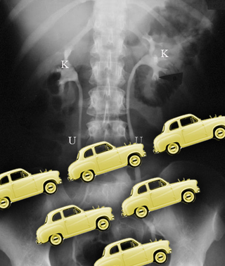Illustration for article titled Why Having To Pee While Driving Is As Bad As Drinking